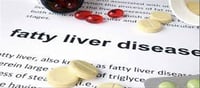 Home remedies for a fatty liver disease?...